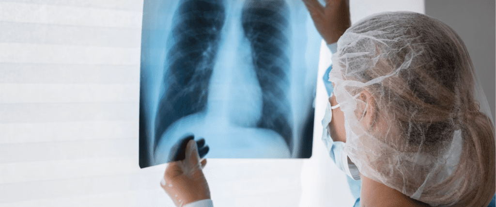 Baner za Radiološku dijagnostiku, doktorka analizira rendgenski snimak pluća.